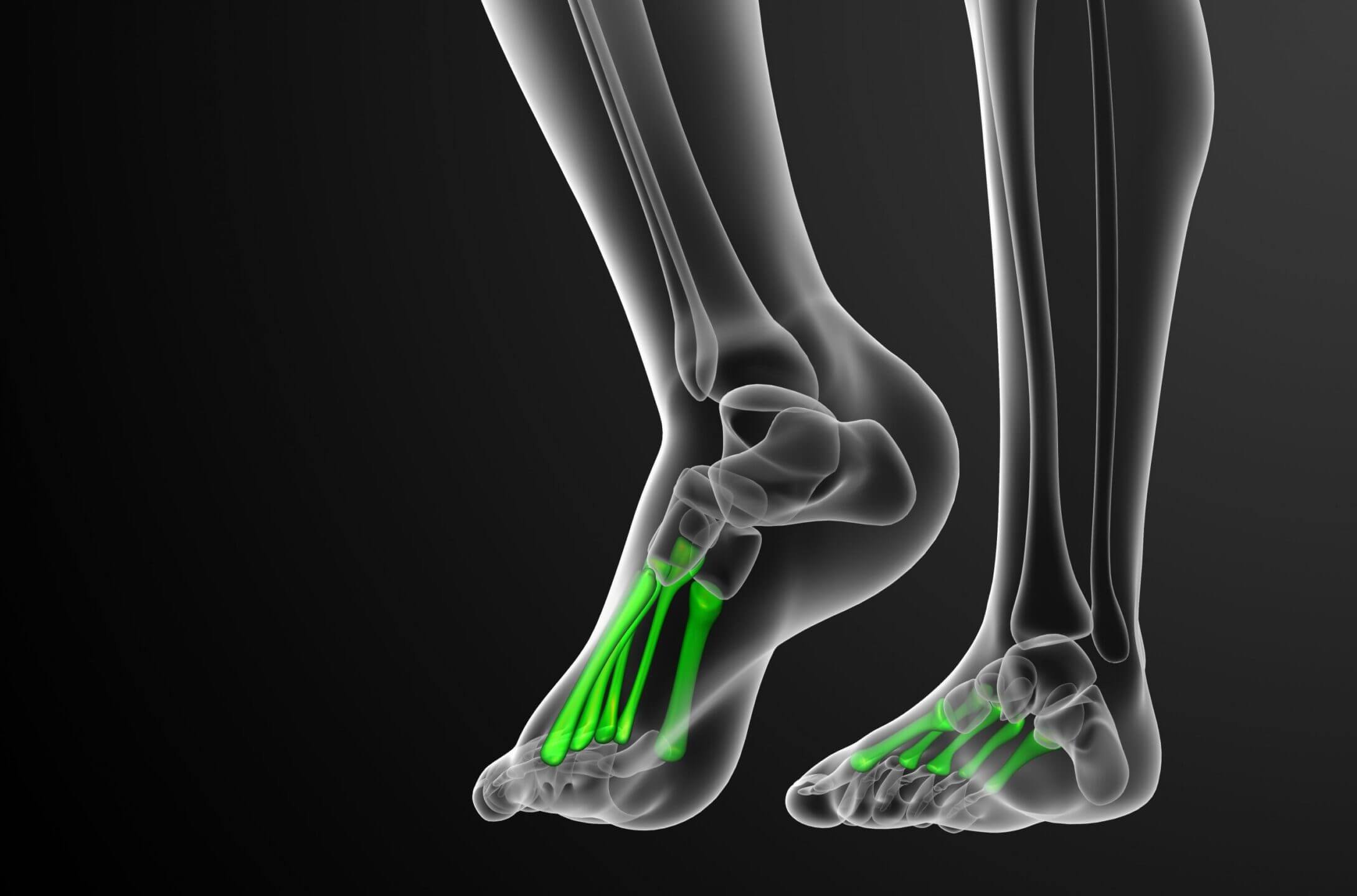 metatarsal bones in feet
