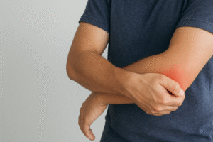 Tennis Elbow Physio