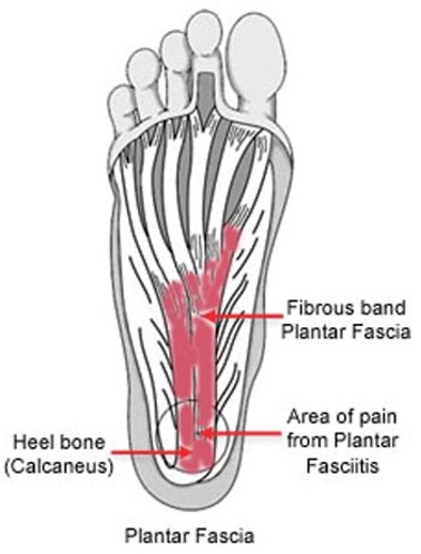 Do you have foot pain?